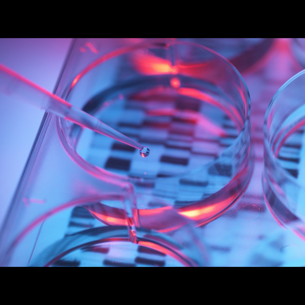 Amplirun® Herpes Simplex 1 DNA Control