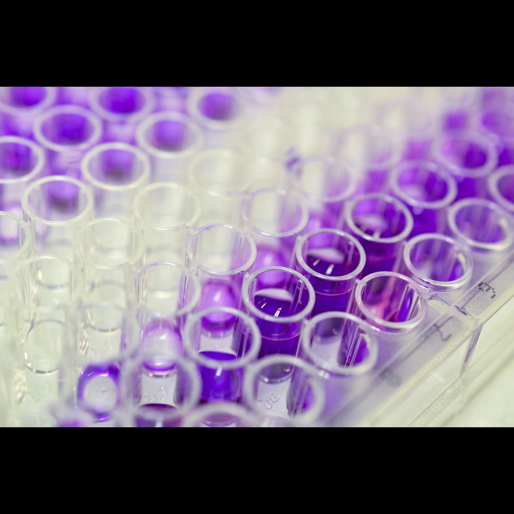 CTXsize:II elisa kit :: Canine Crosssize:Linked Csize:Terminal Telopeptides of Type II Collagen ELISA Kit size: 96 Tests